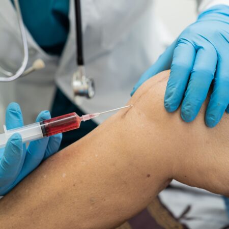 PRP (Platelet Rich Plasma) Training For Joints and Tendons
